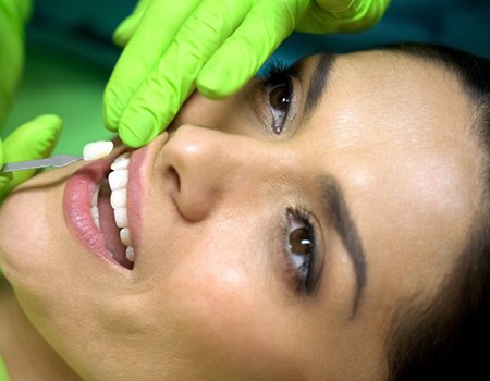 cosmetic dentist placing veneers on woman’s teeth 
