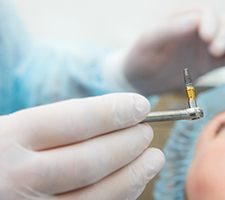 An up-close view of a dental implant preparing to be placed in a patient’s mouth in Azle