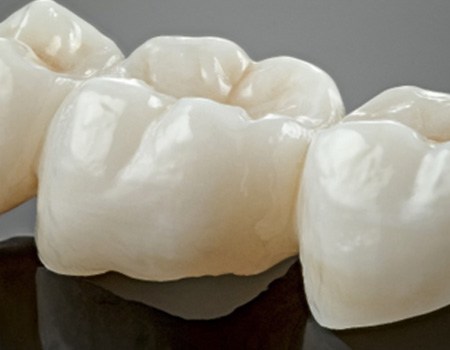 Dental bridge lying on a table