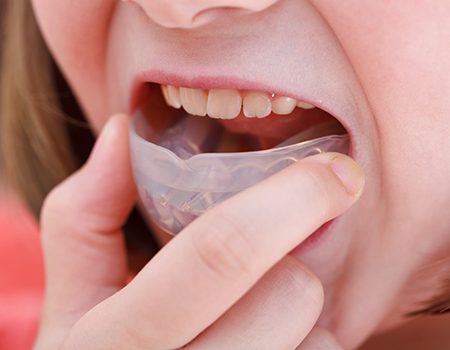 A young child playing a sportsguard into their mouth