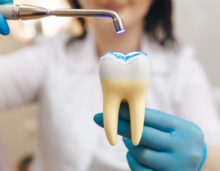 Model of a filled tooth having a light shined on it