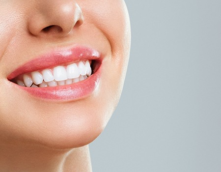 Close-up of woman’s perfect smile after cosmetic dentistry services