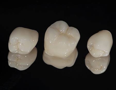 porcelain dental crowns sitting next to each other