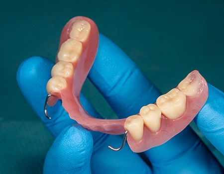 Closeup of dentist holding partial denture