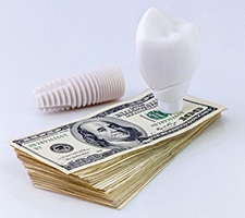 dental implant and crown lying on top of a stack of cash