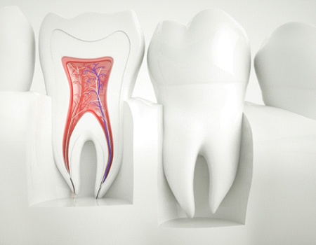 illustration of a root canal in Azle